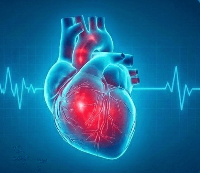 Cardiology