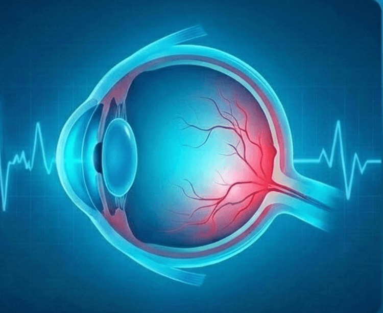 Ophthalmology